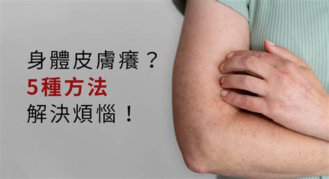 身體好癢|莫名皮膚癢怎麼辦？10種可能原因公開：濕疹、糖尿病。